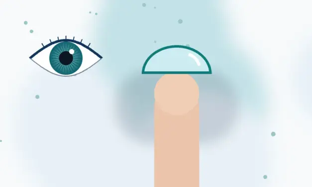 עדשת מגע טורית חדשה DAY ACUVUE® MOIST® for ASTIGMATISM 1