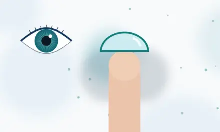 עדשות מגע יומיות עם צלינדר