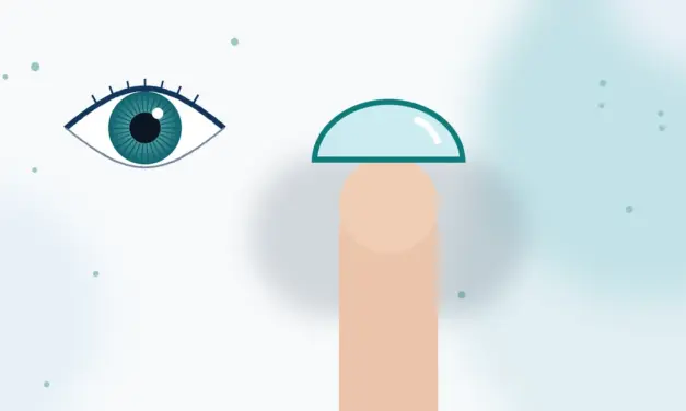 תדירות החלפת עדשות המגע מוטי כהן