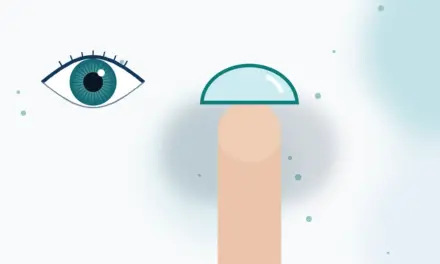 התאמת עדשות מגע- רפי רייזר