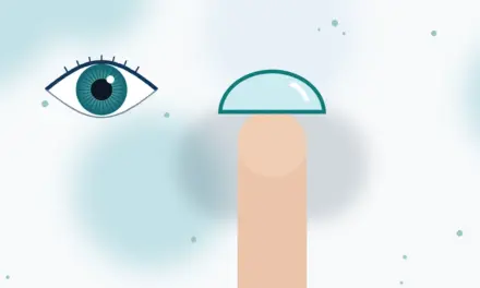 איך עדשות תורמות לעסק, מאת רון חביב
