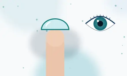 הסקר העולמי בעדשות מגע יורולנס