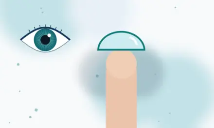 קניית עדשות מגע מייסייט MiSight® 1 day באמצעות אתרי האינטרנט