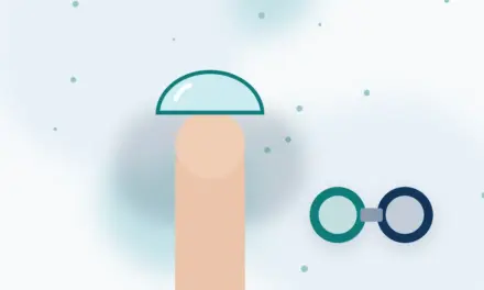 עדשות מגע חודשיות | שאלות ותשובות