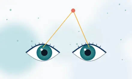 עודף התבדרות (Divergence excess)