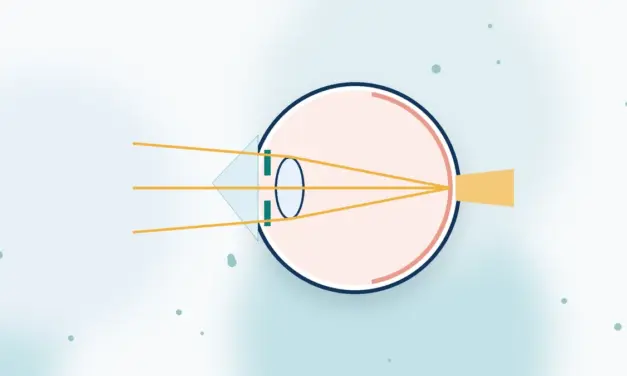 השתלת  CORNEAL STEM CELLS תאי אב קרנית פרופ' ניר ארדינסט, עמית עזריאלי
